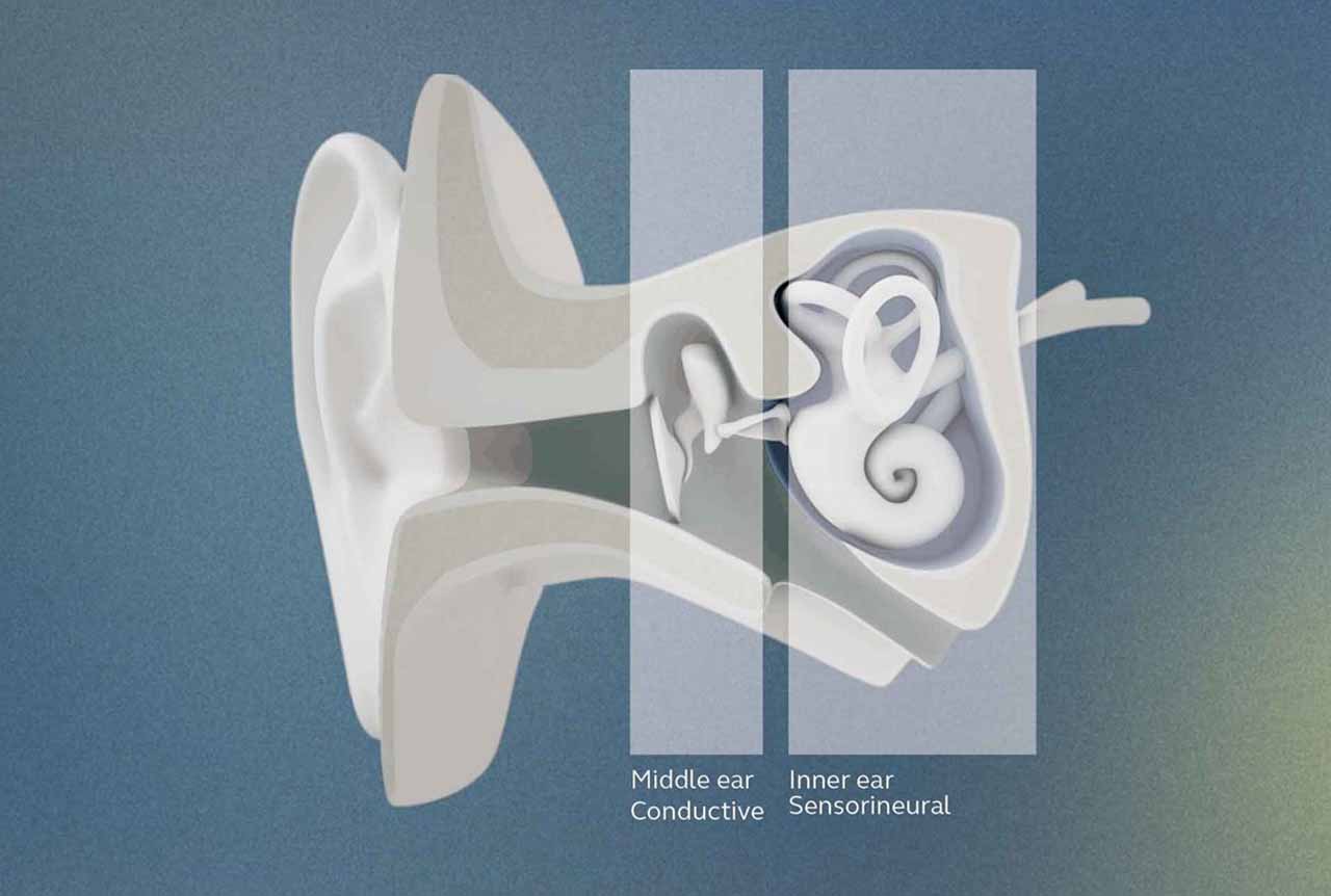entendendo_perda_auditiva